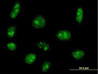 Immunocytochemistry/Immunofluorescence: Exosome component 5 Antibody [H00056915-B01P] - Analysis of purified antibody to EXOSC5 on HeLa cell. (antibody concentration 10 ug/ml)