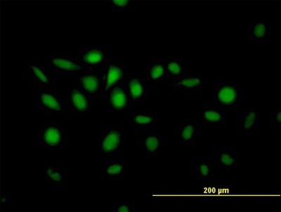 Immunocytochemistry/Immunofluorescence: NFIX Antibody [H00004784-B01P] - Analysis of purified antibody to NFIX on HeLa cell. (antibody concentration 10 ug/ml)