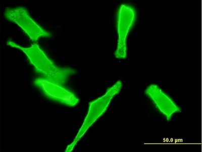 Immunocytochemistry/Immunofluorescence: GUCY2D Antibody (1E6) [H00003000-M06] - Analysis of monoclonal antibody to GUCY2D on HeLa cell. Antibody concentration 10 ug/ml