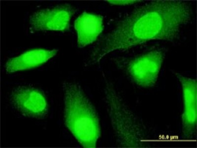 Immunocytochemistry/Immunofluorescence: SP140 Antibody (3F9) [H00011262-M07] - Analysis of monoclonal antibody to SP140 on HeLa cell. Antibody concentration 10 ug/ml