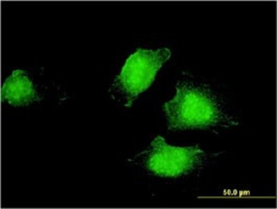 Immunocytochemistry/Immunofluorescence: EDC4 Antibody (2E2) [H00023644-M01] - Analysis of monoclonal antibody to EDC4 on HeLa cell. Antibody concentration 10 ug/ml.
