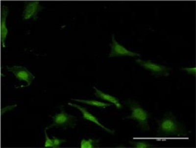 Immunocytochemistry/Immunofluorescence: WBP2 Antibody (3B1) [H00023558-M02] - Analysis of monoclonal antibody to WBP2 on HeLa cell. Antibody concentration 10 ug/ml.
