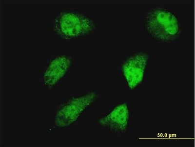 Immunocytochemistry/Immunofluorescence: HOXD11 Antibody (5G4) [H00003237-M03] - Analysis of monoclonal antibody to HOXD11 on HeLa cell. Antibody concentration 10 ug/ml