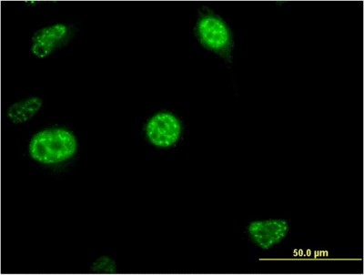 Immunocytochemistry/Immunofluorescence: CDC20B Antibody (2F2) [H00166979-M11] - Analysis of monoclonal antibody to CDC20B on HeLa cell. Antibody concentration 10 ug/ml