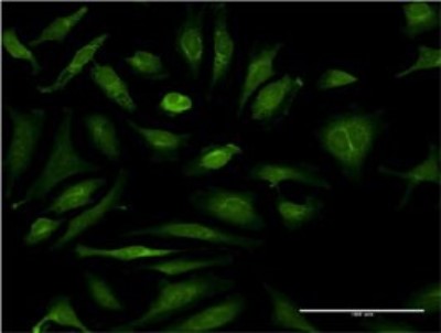 Immunocytochemistry/Immunofluorescence: CSAD Antibody (2C11) [H00051380-M02] - Analysis of monoclonal antibody to CSAD on HeLa cell. Antibody concentration 10 ug/ml.