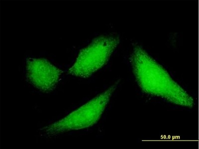 Immunocytochemistry/Immunofluorescence: CPXCR1 Antibody [H00053336-B01P] - Analysis of purified antibody to CPXCR1 on HeLa cell. (antibody concentration 10 ug/ml)