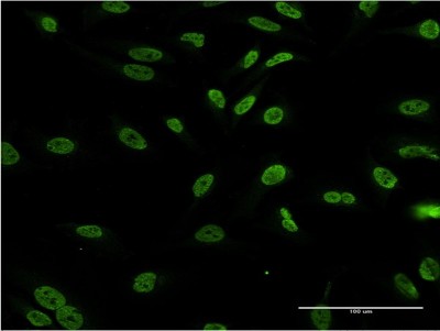 Immunocytochemistry/Immunofluorescence: Dlx1 Antibody (3F9) [H00001745-M03] - Analysis of monoclonal antibody to DLX1 on HeLa cell. Antibody concentration 10 ug/ml