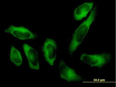 Immunocytochemistry/Immunofluorescence: Alanyl tRNA synthetase Antibody [H00000016-B01P] - Analysis of purified antibody to AARS on HeLa cell. (antibody concentration 10 ug/ml)