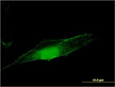 Immunocytochemistry/Immunofluorescence: O-GlcNAcase/OGA/MGEA5 Antibody (1C7) [H00010724-M02] - Analysis of monoclonal antibody to MGEA5 on HeLa cell. Antibody concentration 10 ug/ml.