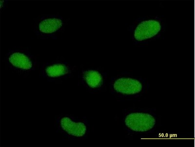 Immunocytochemistry/Immunofluorescence: RPP40 Antibody [H00010799-B01P] - Analysis of purified antibody to RPP40 on HeLa cell. (antibody concentration 10 ug/ml)