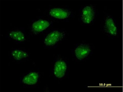 Immunocytochemistry/Immunofluorescence: FLJ11184 Antibody [H00055319-B01P] - Analysis of purified antibody to FLJ11184 on HeLa cell. (antibody concentration 10 ug/ml)