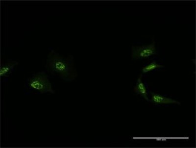 Immunocytochemistry/Immunofluorescence: MED4 Antibody (2B10) [H00029079-M01] - Analysis of monoclonal antibody to MED4 on HeLa cell. Antibody concentration 10 ug/ml.