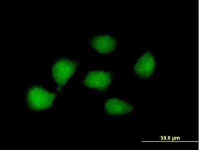 Immunocytochemistry/Immunofluorescence: KLF8 Antibody [H00011279-B01P] - Analysis of purified antibody to KLF8 on HeLa cell. (antibody concentration 10 ug/ml)