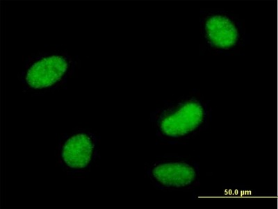 Immunocytochemistry/Immunofluorescence: SmarcAL1 Antibody [H00050485-B01P] - Analysis of purified antibody to SMARCAL1 on HeLa cell. (antibody concentration 10 ug/ml)