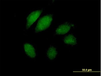 Immunocytochemistry/Immunofluorescence: AIMP2 Antibody [H00007965-B01P] - Analysis of purified antibody to JTV1 on HeLa cell. (antibody concentration 10 ug/ml)