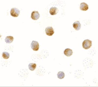Immunocytochemistry/Immunofluorescence: DFF40/CAD Antibody [NBP1-76884] - Jurkat cells with DFF40 antibody at 5 ug/mL.
