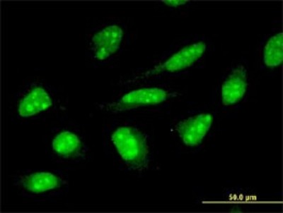 Immunocytochemistry/Immunofluorescence: ZNF396 Antibody (2F8) [H00252884-M01] - Analysis of monoclonal antibody to ZNF396 on HeLa cell. Antibody concentration 10 ug/ml.
