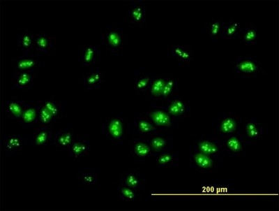 Immunocytochemistry/Immunofluorescence: RSL1D1 Antibody [H00026156-B01P] - Analysis of purified antibody to RSL1D1 on HeLa cell. (antibody concentration 10 ug/ml)