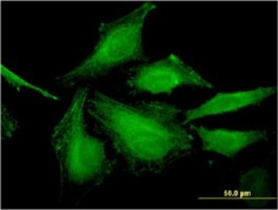 Immunocytochemistry/Immunofluorescence: HSFY2 Antibody (4B7) [H00159119-M02] - Analysis of monoclonal antibody to HSFY2 on HeLa cell. Antibody concentration 10 ug/ml.