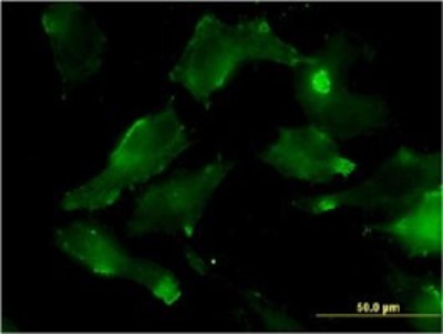 Immunocytochemistry/Immunofluorescence: HSD17B7 Antibody (1G10) [H00051478-M01] - Analysis of monoclonal antibody to HSD17B7 on HeLa cell. Antibody concentration 10 ug/ml.