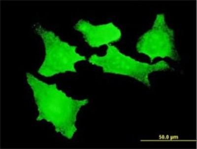 Immunocytochemistry/Immunofluorescence: CDKL2 Antibody (1F6) [H00008999-M01] - Analysis of monoclonal antibody to CDKL2 on HeLa cell. Antibody concentration 10 ug/ml.
