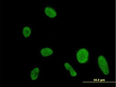Immunocytochemistry/Immunofluorescence: DIP2A Antibody [H00023181-B01P] - Analysis of purified antibody to DIP2A on HeLa cell. (antibody concentration 10 ug/ml)