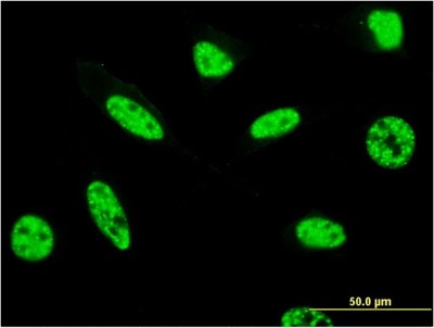 Immunocytochemistry/Immunofluorescence: PSRC2 Antibody (3A3) [H00196441-M07] - Analysis of monoclonal antibody to ZFC3H1 on HeLa cell. Antibody concentration 10 ug/ml