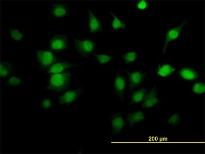 Immunocytochemistry/Immunofluorescence: PDE6D Antibody (5C7) [H00005147-M06] - Analysis of monoclonal antibody to PDE6D on HeLa cell. Antibody concentration 20 ug/ml