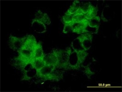 Immunocytochemistry/Immunofluorescence: KRTHA3B Antibody (4A6-A7) [H00003884-M01] - Analysis of monoclonal antibody to KRTHA3B on MCF-7 cell. Antibody concentration 10 ug/ml.