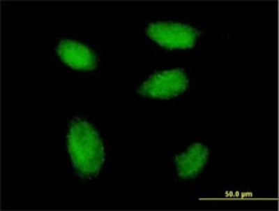 Immunocytochemistry/Immunofluorescence: RSF1 Antibody (3E6) [H00051773-M05] - Analysis of monoclonal antibody to RSF1 on HeLa cell. Antibody concentration 10 ug/ml