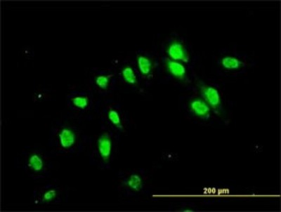 Immunocytochemistry/Immunofluorescence: Njmu-R1 Antibody (3F8) [H00064149-M01] - Analysis of monoclonal antibody to C17orf75 on HeLa cell. Antibody concentration 10 ug/ml.