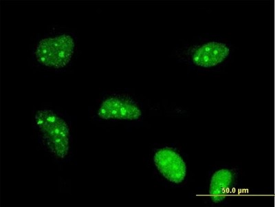 Immunocytochemistry/Immunofluorescence: POLR1B Antibody (4H6) [H00084172-M10] - Analysis of monoclonal antibody to POLR1B on HeLa cell. Antibody concentration 10 ug/ml