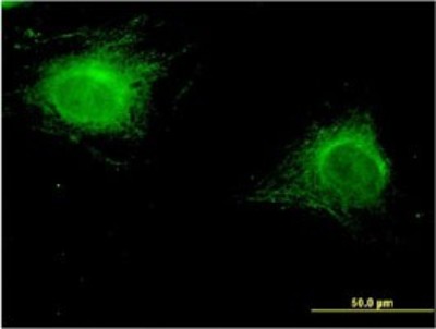 Immunocytochemistry/Immunofluorescence: ZNF239 Antibody (2D9) [H00008187-M27] - Analysis of monoclonal antibody to ZNF239 on HeLa cell. Antibody concentration 10 ug/ml