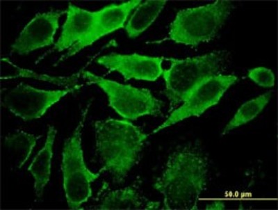Immunocytochemistry/Immunofluorescence: Synaptobrevin homolog YKT6 Antibody (1F8) [H00010652-M03] - Analysis of monoclonal antibody to YKT6 on HeLa cell. Antibody concentration 10 ug/ml