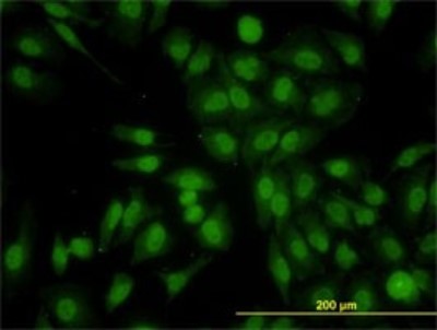 Immunocytochemistry/Immunofluorescence: RALGPS2 Antibody (3F1) [H00055103-M01] - Analysis of monoclonal antibody to RALGPS2 on HeLa cell. Antibody concentration 10 ug/ml.