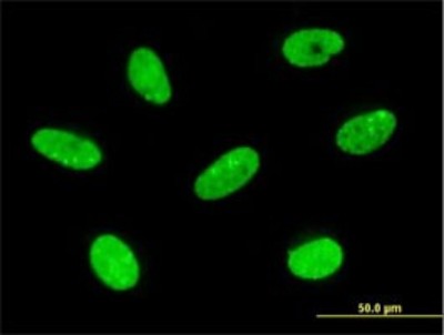 Immunocytochemistry/Immunofluorescence: LBX2 Antibody (3A5) [H00085474-M02] - Analysis of monoclonal antibody to LBX2 on HeLa cell. Antibody concentration 10 ug/ml.