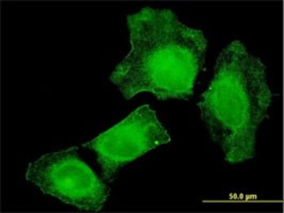 Immunocytochemistry/Immunofluorescence: TIAM2 Antibody (3C1) [H00026230-M01] - Analysis of monoclonal antibody to TIAM2 on HeLa cell. Antibody concentration 10 ug/ml.