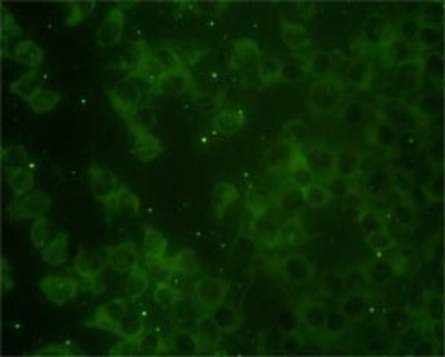Immunocytochemistry/Immunofluorescence: Rap2B Antibody (4F12-3C6) [H00005912-M01] - Analysis of monoclonal antibody to RAP2B on HeLa cell. Antibody concentration 10 ug/ml.