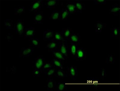 Immunocytochemistry/Immunofluorescence: TRIM49 Antibody (3C7) [H00057093-M05] - Analysis of monoclonal antibody to TRIM49 on HeLa cell. Antibody concentration 10 ug/ml