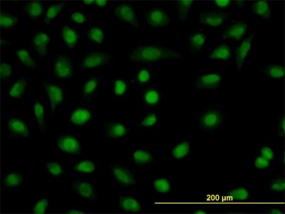 Immunocytochemistry/Immunofluorescence: DBPA Antibody (1H5) [H00008531-M06] - Analysis of monoclonal antibody to CSDA on HeLa cell. Antibody concentration 10 ug/ml
