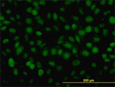 Immunocytochemistry/Immunofluorescence: RAD54B Antibody (4A7) [H00025788-M01] - Analysis of monoclonal antibody to RAD54B on HeLa cell. Antibody concentration 10 ug/ml.