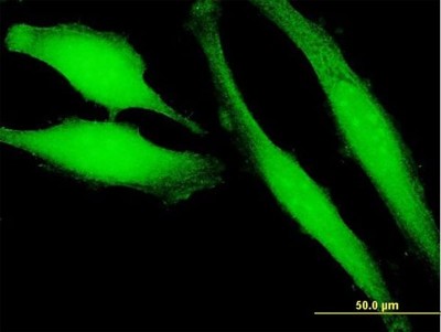 Immunocytochemistry/Immunofluorescence: PLA2G16/HRASLS3 Antibody [H00011145-B01P] - Analysis of purified antibody to HRASLS3 on HeLa cell. (antibody concentration 10 ug/ml)