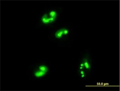 Immunocytochemistry/Immunofluorescence: MRTO4 Antibody (1C12) [H00051154-M01] - Analysis of monoclonal antibody to C1orf33 on HepG2 cell. Antibody concentration 10 ug/ml.