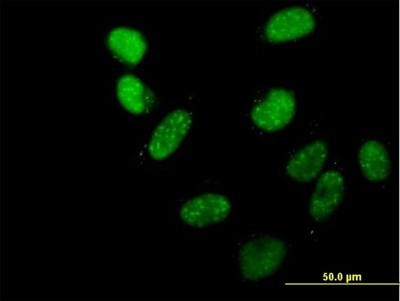 Immunocytochemistry/Immunofluorescence: MRG-binding protein Antibody [H00055257-B01P] - Analysis of purified antibody to C20orf20 on HeLa cell. (antibody concentration 10 ug/ml)