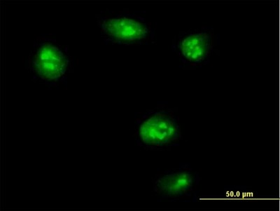 Immunocytochemistry/Immunofluorescence: TEAD4 Antibody [H00007004-B01P] - Analysis of purified antibody to TEAD4 on HeLa cell. (antibody concentration 10 ug/ml)