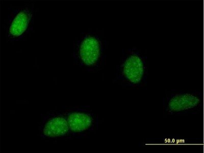 Immunocytochemistry/Immunofluorescence: WDR9 Antibody [H00054014-B01P] - Analysis of purified antibody to BRWD1 on HeLa cell. (antibody concentration 10 ug/ml)