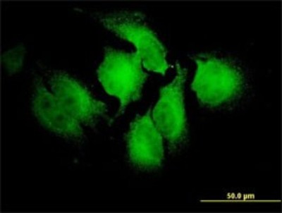 Immunocytochemistry/Immunofluorescence: NT2NL Antibody (2G12-2A5) [H00388677-M01] - Analysis of monoclonal antibody to NOTCH2NL on HeLa cell. Antibody concentration 10 ug/ml.