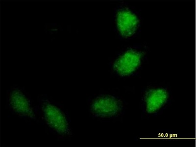 Immunocytochemistry/Immunofluorescence: TRIM40 Antibody [H00135644-B01P] - Analysis of purified antibody to TRIM40 on HeLa cell. (antibody concentration 10 ug/ml)