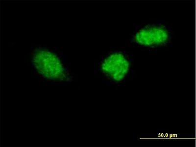 Immunocytochemistry/Immunofluorescence: ZWINT Antibody [H00011130-B01P] - Analysis of purified antibody to ZWINT on HeLa cell. (antibody concentration 10 ug/ml)