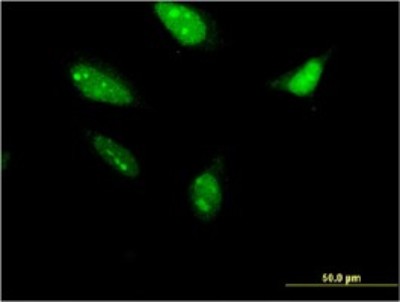 Immunocytochemistry/Immunofluorescence: RNF212 Antibody (5H3) [H00285498-M01] - Analysis of monoclonal antibody to RNF212 on HeLa cell. Antibody concentration 10 ug/ml.